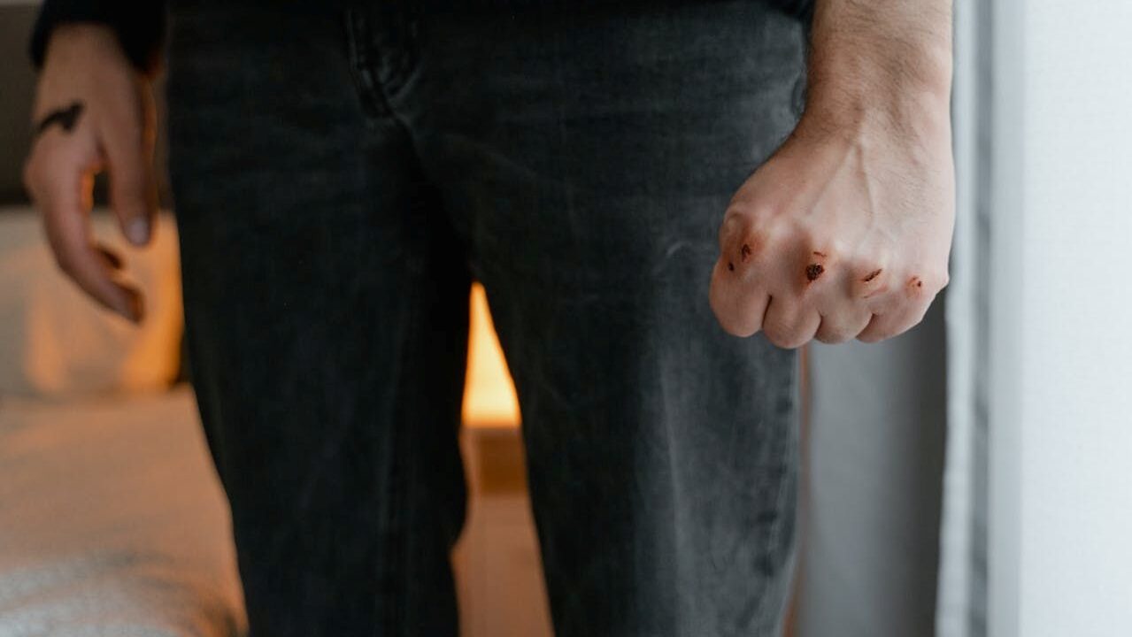 Przestępstwo uszkodzenia ciała (art. 157 kk) – definicja, rodzaje i odpowiedzialność karna